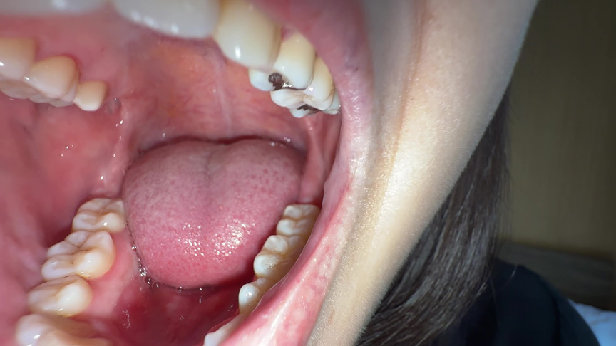 「【湊波流】舌ブラシで舌苔採取する個人撮影フェチ動画｜唾液・口腔マニア必見」のサンプル画像9枚目