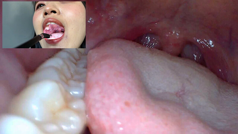 「【素人ナンパ】コールセンター勤務の美人お姉さんに街角で声かけ!口内観察に恥じらう姿が可愛すぎる」のサンプル画像10枚目