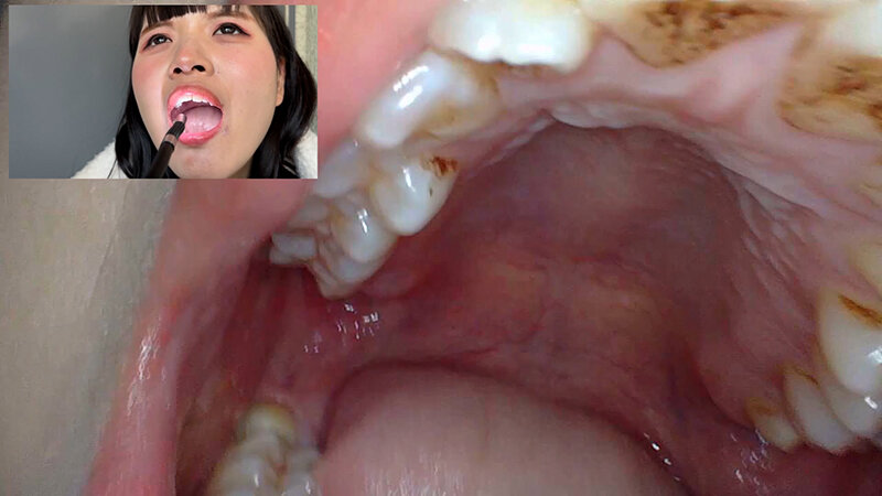 「【素人ナンパ】コールセンター勤務の美人お姉さんに街角で声かけ!口内観察に恥じらう姿が可愛すぎる」のサンプル画像12枚目