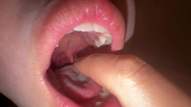 「【七藤優亜】超長舌お姉さんの開口器観察プレイ|素人個人撮影で魅せる濃厚舌技」のサンプル画像8枚目