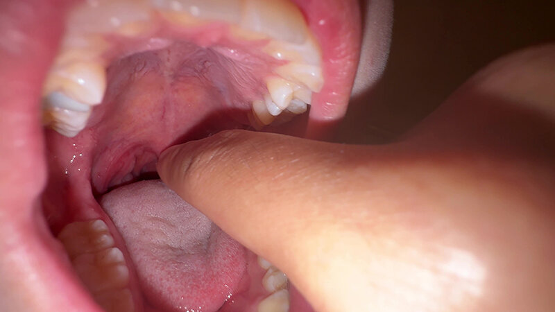 「【七藤優亜】超長舌お姉さんの開口器観察プレイ|素人個人撮影で魅せる濃厚舌技」のサンプル画像9枚目