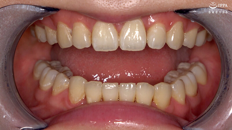 「横峯めぐの口内・歯・のどちんこ観察プレイ!清楚系美少女M女が魅せる貴重映像」のサンプル画像6枚目