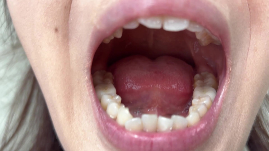 「【素人8名】口腔観察フェチ動画【歯・舌・喉チェック】150分大容量お得セット」のサンプル画像7枚目