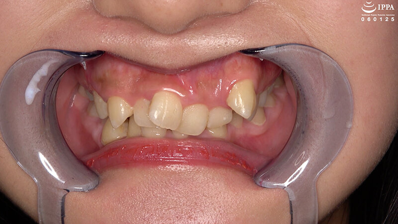 「【相楽さゆな】美少女M女の口内観察&巨大女フェチプレイ|歯・口腔フェチ動画」のサンプル画像2枚目