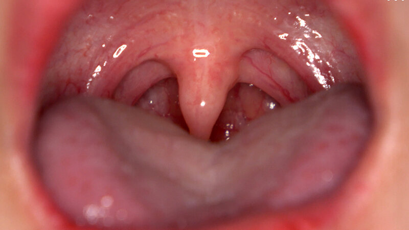 「【相楽さゆな】美少女M女の口内観察&巨大女フェチプレイ|歯・口腔フェチ動画」のサンプル画像7枚目