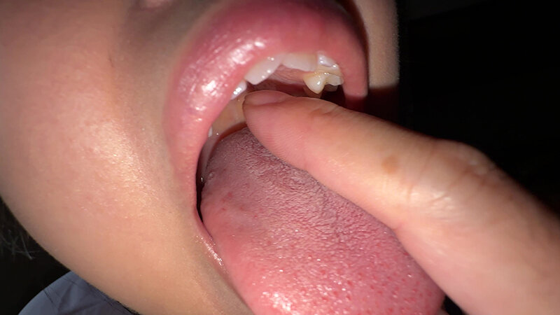 「【谷田かりな】素人お姉さんをナンパ！開口器で口内観察デカ舌チェック【個人撮影】」のサンプル画像12枚目