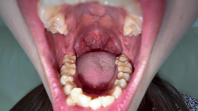 「【水月みお】素人お姉さんをナンパ!初めての喉奥体験と舌・八重歯観察の個人撮影動画」のサンプル画像4枚目