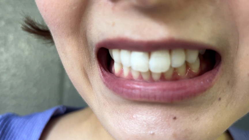 「【口腔観察】歯・舌・喉をじっくり見せる美女4名の口内フェチ動画【お得セット】」のサンプル画像8枚目