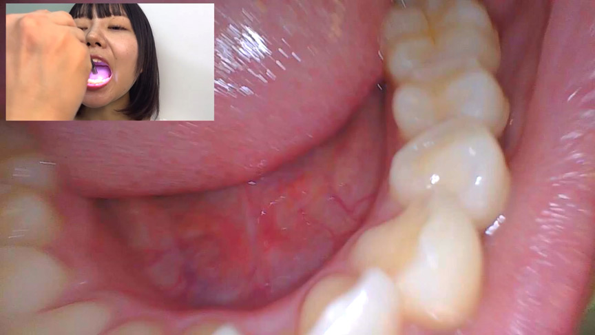 「【素人AD】みゆりちゃんの口内観察プレイ|街角ナンパ企画で歯・舌・喉をじっくり撮影【フェチ動画】」のサンプル画像14枚目