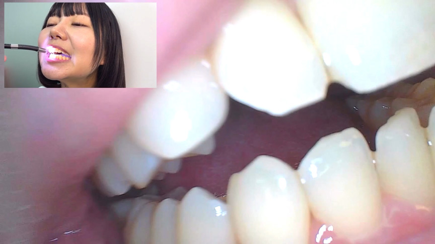 「【素人AD】みゆりちゃんの口内観察プレイ|街角ナンパ企画で歯・舌・喉をじっくり撮影【フェチ動画】」のサンプル画像15枚目
