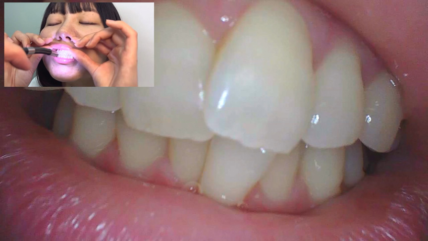 「【素人AD】みゆりちゃんの口内観察プレイ|街角ナンパ企画で歯・舌・喉をじっくり撮影【フェチ動画】」のサンプル画像16枚目