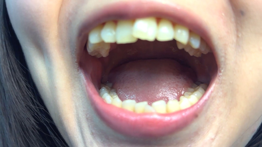 「【素人AD】みゆりちゃんの口内観察プレイ|街角ナンパ企画で歯・舌・喉をじっくり撮影【フェチ動画】」のサンプル画像2枚目