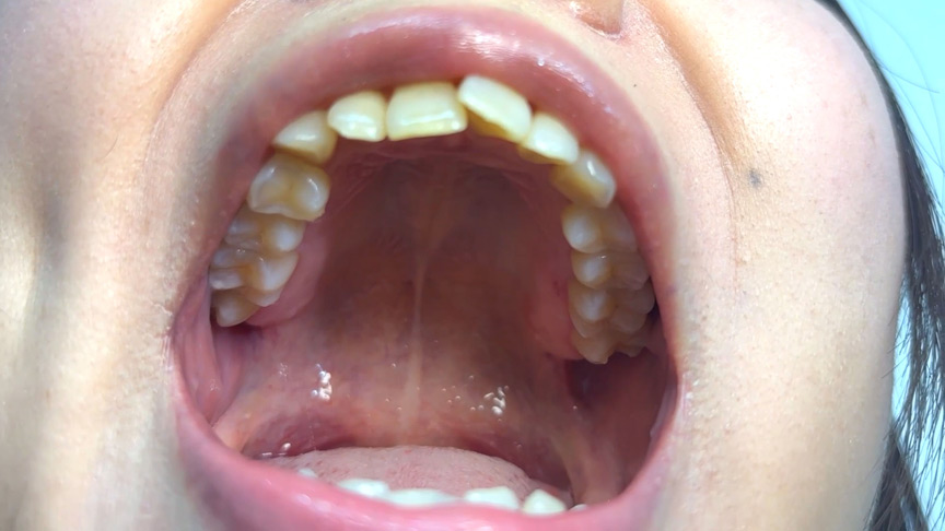 「【素人AD】みゆりちゃんの口内観察プレイ|街角ナンパ企画で歯・舌・喉をじっくり撮影【フェチ動画】」のサンプル画像4枚目