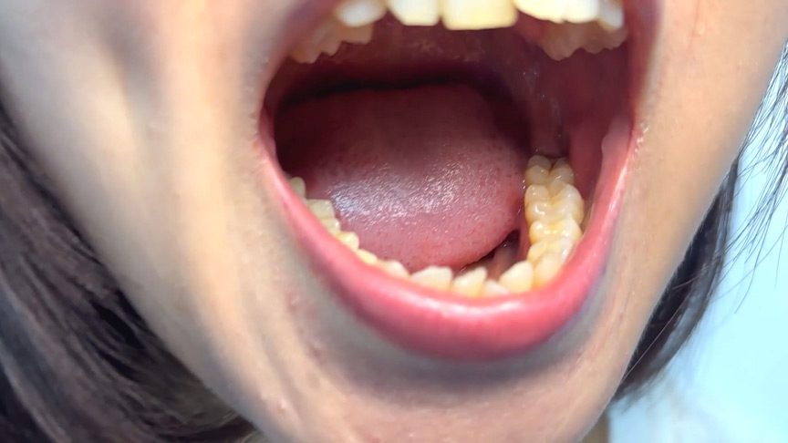 「【素人AD】みゆりちゃんの口内観察プレイ|街角ナンパ企画で歯・舌・喉をじっくり撮影【フェチ動画】」のサンプル画像5枚目