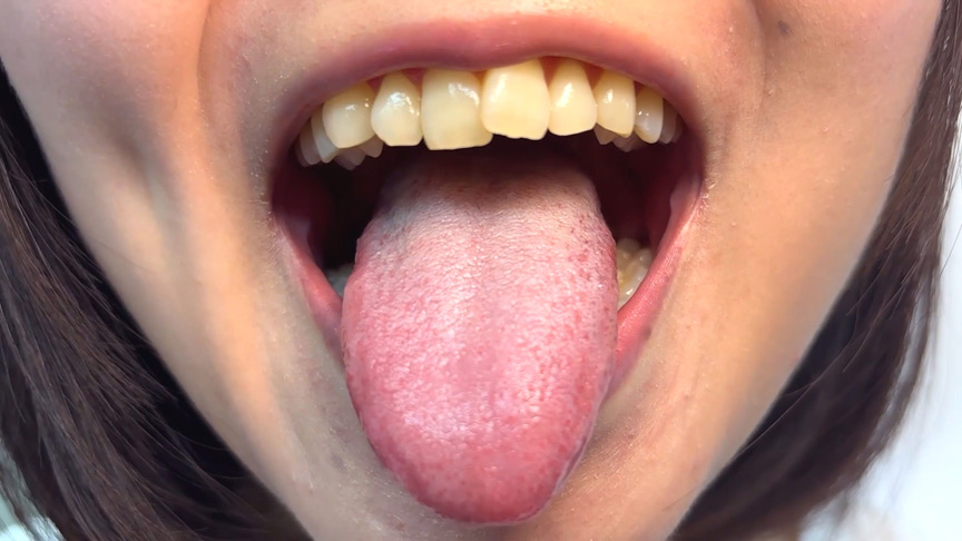 「【素人AD】みゆりちゃんの口内観察プレイ|街角ナンパ企画で歯・舌・喉をじっくり撮影【フェチ動画】」のサンプル画像7枚目