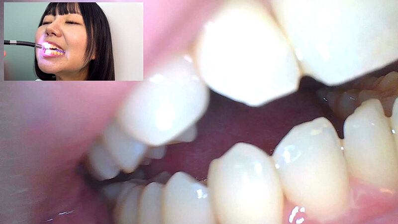 「【素人ナンパ】街角お姉さんみゆりちゃんの口内観察!テレビ局AD美女が恥じらい体験」のサンプル画像15枚目