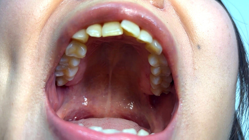 「【素人ナンパ】街角お姉さんみゆりちゃんの口内観察!テレビ局AD美女が恥じらい体験」のサンプル画像4枚目